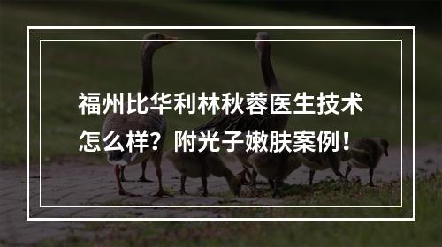 福州比华利林秋蓉医生技术怎么样？附光子嫩肤案例！