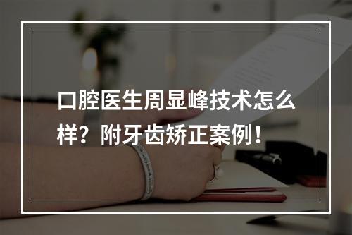 口腔医生周显峰技术怎么样？附牙齿矫正案例！