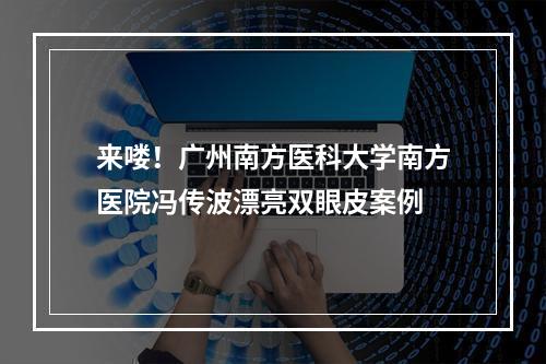 来喽！广州南方医科大学南方医院冯传波漂亮双眼皮案例