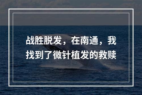 战胜脱发，在南通，我找到了微针植发的救赎