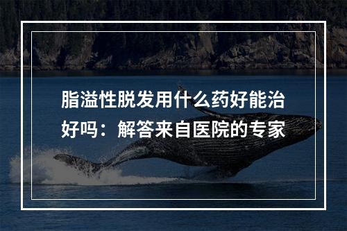 脂溢性脱发用什么药好能治好吗：解答来自医院的专家