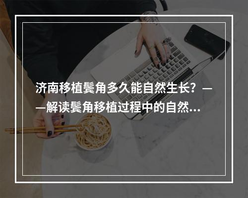 济南移植鬓角多久能自然生长？——解读鬓角移植过程中的自然生长