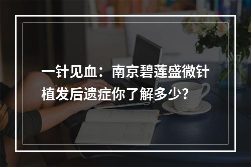 一针见血：南京碧莲盛微针植发后遗症你了解多少？