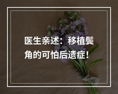 医生亲述：移植鬓角的可怕后遗症！