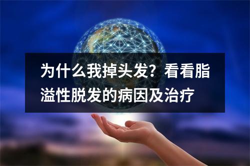 为什么我掉头发？看看脂溢性脱发的病因及治疗