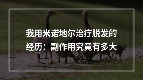 我用米诺地尔治疗脱发的经历：副作用究竟有多大