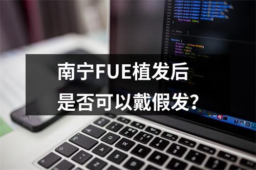 南宁FUE植发后是否可以戴假发？