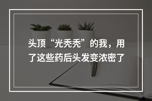 头顶“光秃秃”的我，用了这些药后头发变浓密了