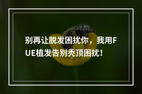 别再让脱发困扰你，我用FUE植发告别秃顶困扰！