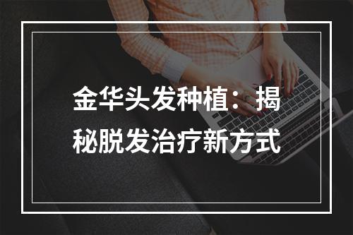 金华头发种植：揭秘脱发治疗新方式