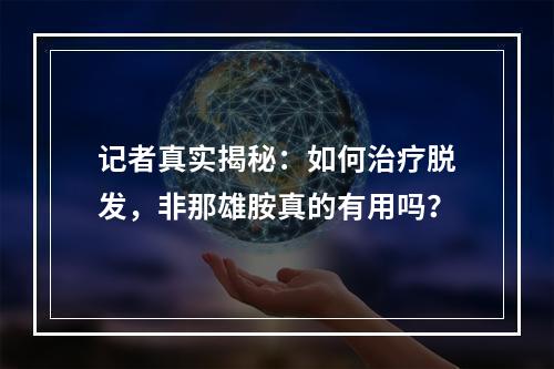 记者真实揭秘：如何治疗脱发，非那雄胺真的有用吗？