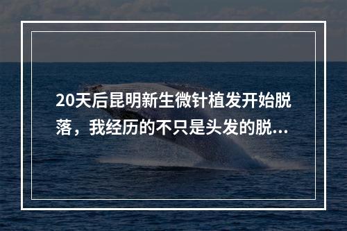 20天后昆明新生微针植发开始脱落，我经历的不只是头发的脱落