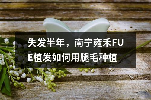 失发半年，南宁雍禾FUE植发如何用腿毛种植