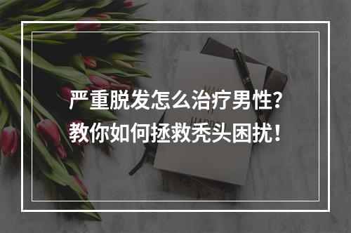 严重脱发怎么治疗男性？教你如何拯救秃头困扰！