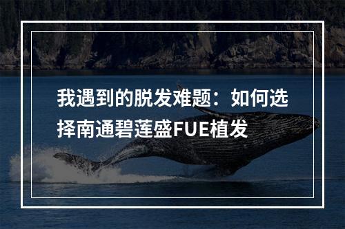 我遇到的脱发难题：如何选择南通碧莲盛FUE植发