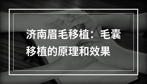 济南眉毛移植：毛囊移植的原理和效果