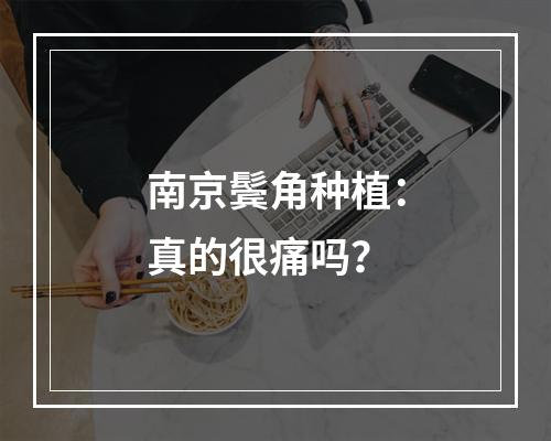 南京鬓角种植：真的很痛吗？