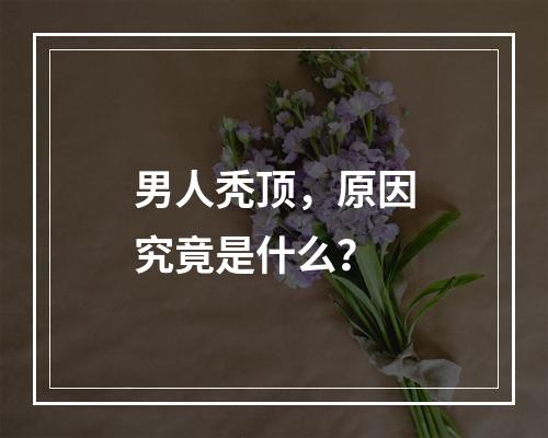 男人秃顶，原因究竟是什么？