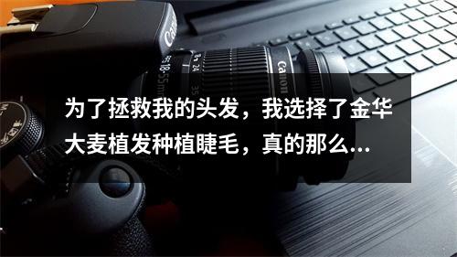 为了拯救我的头发，我选择了金华大麦植发种植睫毛，真的那么贵吗？