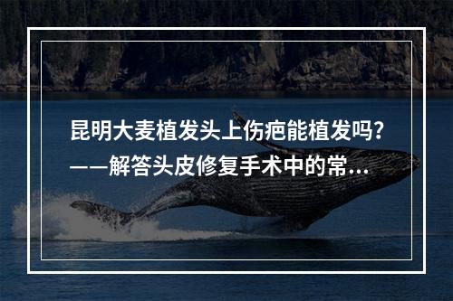 昆明大麦植发头上伤疤能植发吗？——解答头皮修复手术中的常见疑问