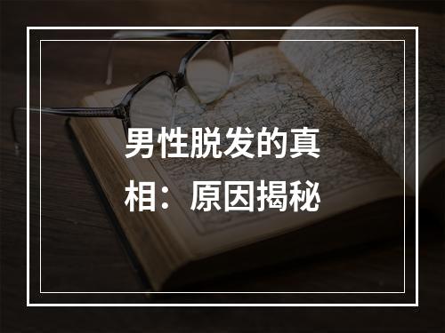 男性脱发的真相：原因揭秘