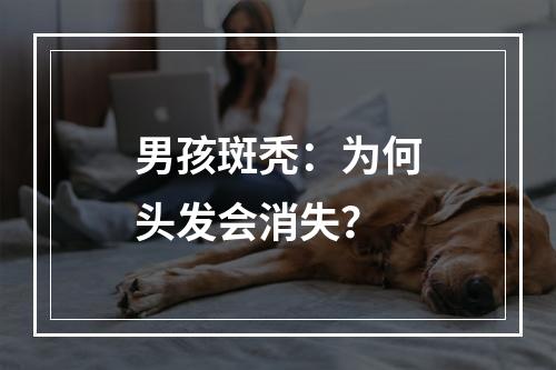 男孩斑秃：为何头发会消失？