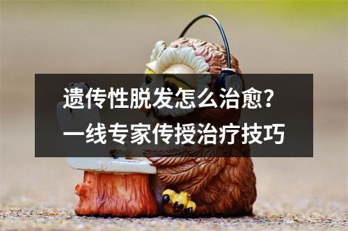 遗传性脱发怎么治愈？一线专家传授治疗技巧