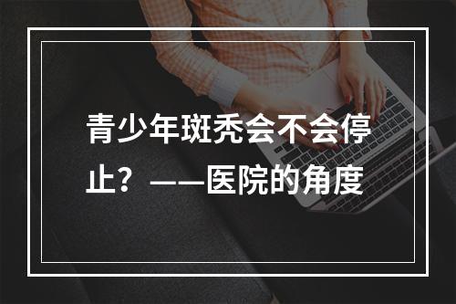 青少年斑秃会不会停止？——医院的角度