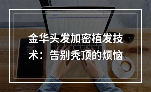 金华头发加密植发技术：告别秃顶的烦恼