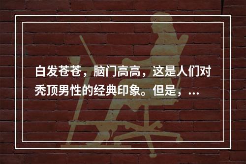 白发苍苍，脑门高高，这是人们对秃顶男性的经典印象。但是，一些女性也可能在头部出现秃发现象，这让人把目光引向了秃顶是否会遗传给女性这一问题上。