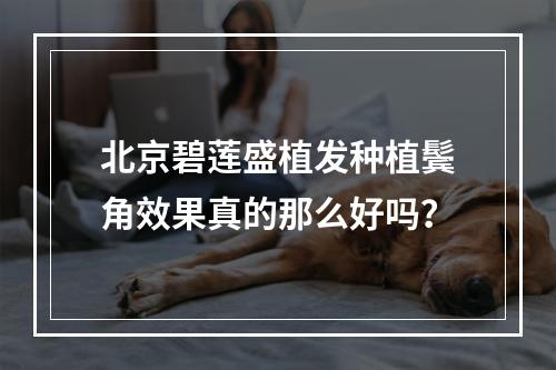 北京碧莲盛植发种植鬓角效果真的那么好吗？