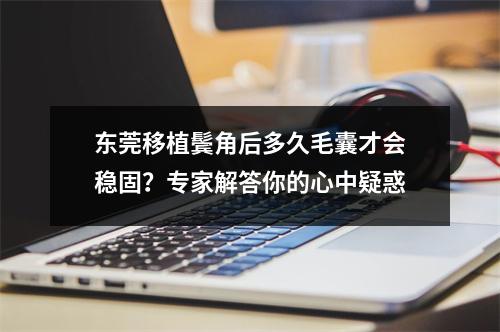 东莞移植鬓角后多久毛囊才会稳固？专家解答你的心中疑惑