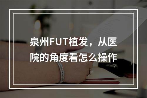 泉州FUT植发，从医院的角度看怎么操作