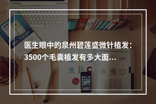 医生眼中的泉州碧莲盛微针植发：3500个毛囊植发有多大面积