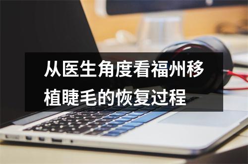 从医生角度看福州移植睫毛的恢复过程