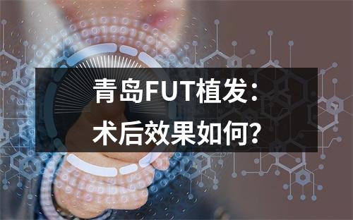 青岛FUT植发：术后效果如何？