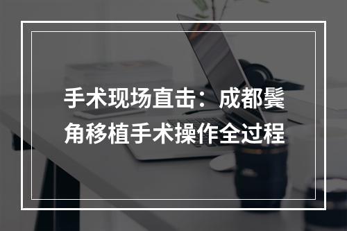 手术现场直击：成都鬓角移植手术操作全过程