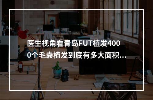 医生视角看青岛FUT植发4000个毛囊植发到底有多大面积？