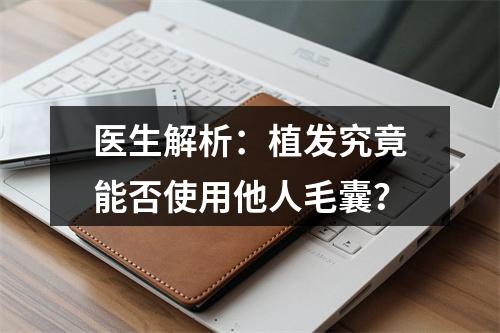 医生解析：植发究竟能否使用他人毛囊？