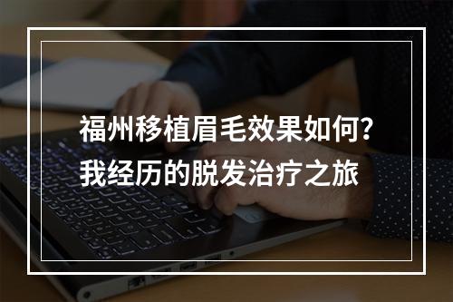 福州移植眉毛效果如何？我经历的脱发治疗之旅