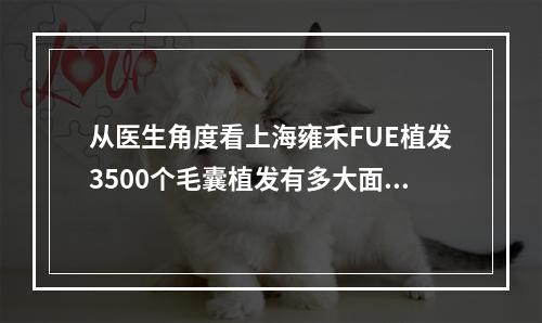 从医生角度看上海雍禾FUE植发3500个毛囊植发有多大面积