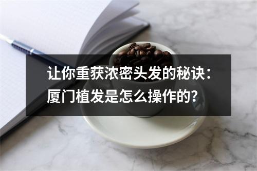 让你重获浓密头发的秘诀：厦门植发是怎么操作的？