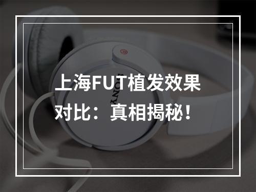 上海FUT植发效果对比：真相揭秘！