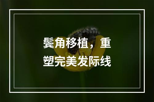 鬓角移植，重塑完美发际线