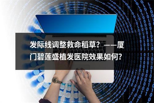 发际线调整救命稻草？——厦门碧莲盛植发医院效果如何？