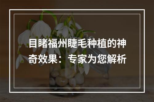 目睹福州睫毛种植的神奇效果：专家为您解析