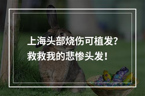 上海头部烧伤可植发？救救我的悲惨头发！