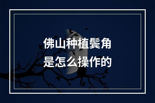 佛山种植鬓角是怎么操作的