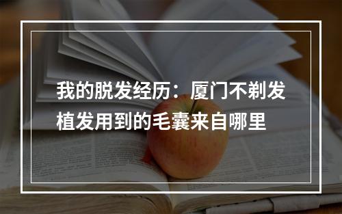 我的脱发经历：厦门不剃发植发用到的毛囊来自哪里