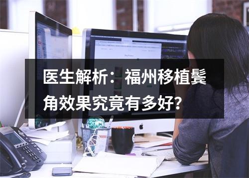 医生解析：福州移植鬓角效果究竟有多好？